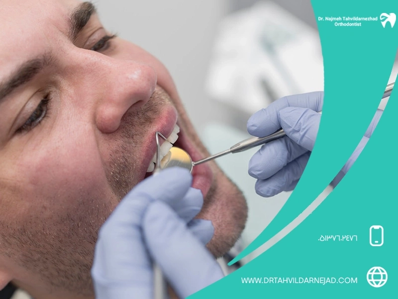 پر کردن دندان با آمالگام چیست؟ مزایا، معایب و مقایسه با مواد سفید