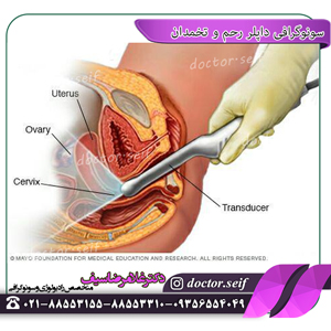 سونوگرافی داپلر رحم و تخمدان چگونه انجام می شود؟