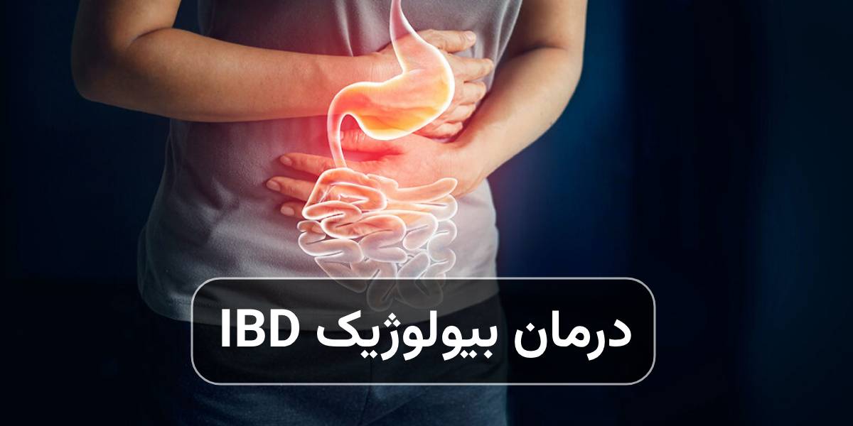 درمان بیولوژیکی IBD؛ جدیدترین داروهای روز دنیا - کلینیک بیماریهای التهابی روده