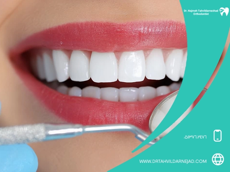 همه چیز درباره جرم گیری و بلیچینگ دندان: کدام روش بهتر است؟