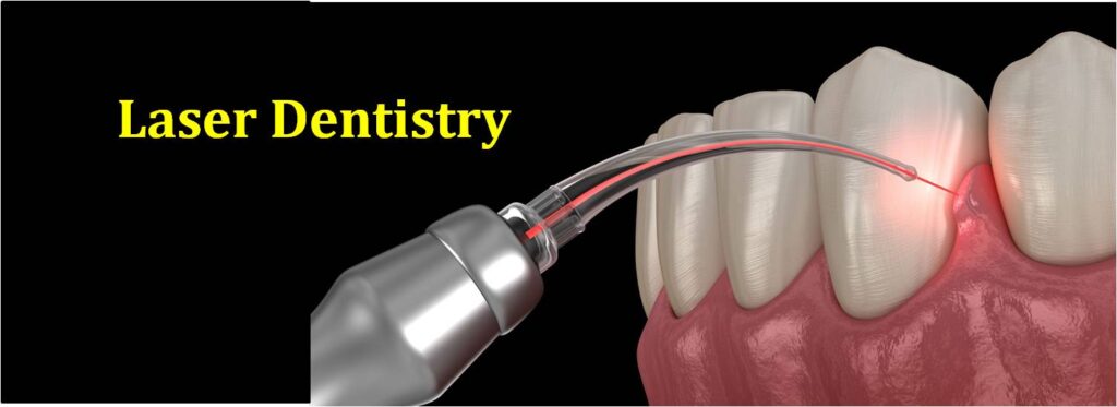 use of laser in root treatment; New technology in increasing endodontic success - Dr. Mojtaba Jirani, specialist in root canal therapy