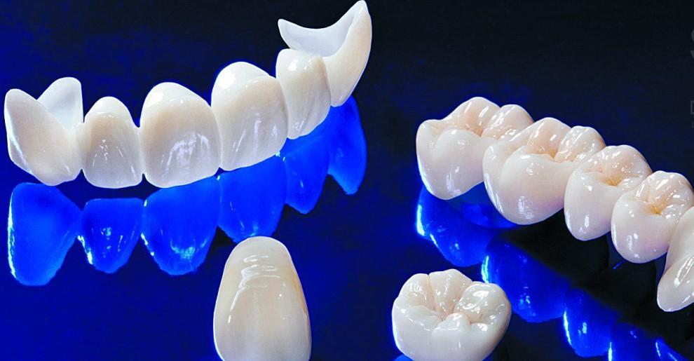 Comparison of zirconia veneer and PFM; Which dental veneer is a better choice? - Dr. Mojtaba Jirani, specialist in root canal therapy