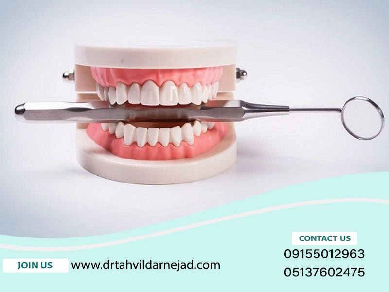 الإلمام بزراعة الأسنان لدى مرضى السكري + مخاطر زراعة الأسنان لمرضى السكري تسليم دارنجاد