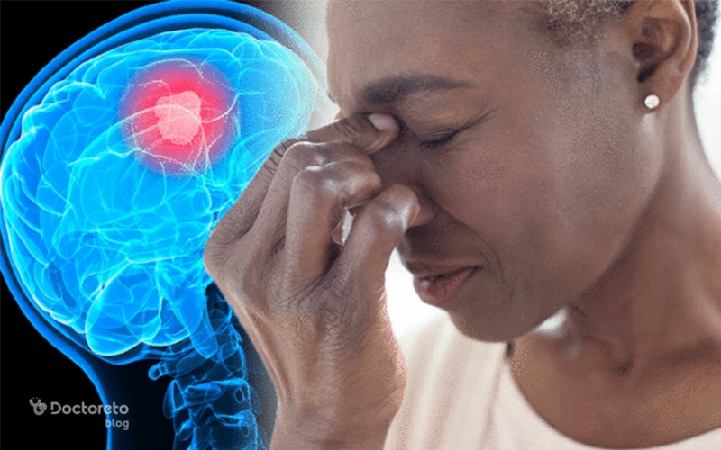 آیا تومورهای مغزی و سردرد مرتبط هستند؟