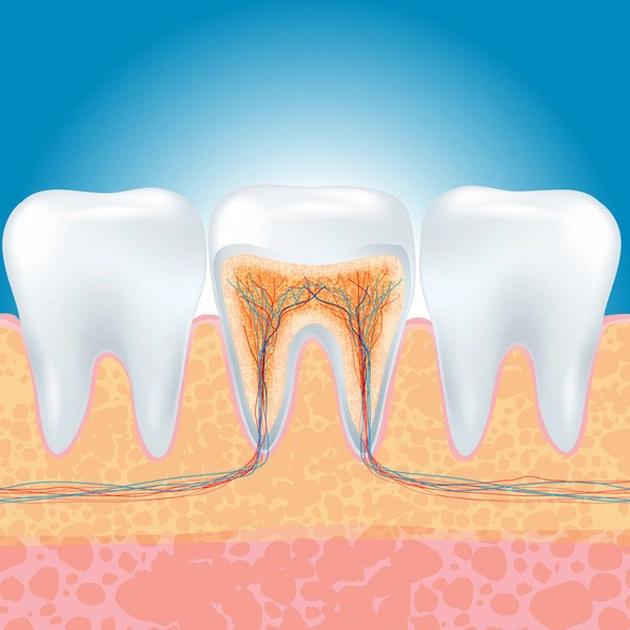 re-root treatment in Karaj; What should be done when the previous nerve extraction was not successful? - Dr. Mojtaba Jirani, specialist in root canal therapy