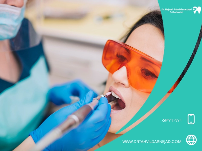 پر کردن دندان با لیزر مزایا، روش ها و هزینه دندانپزشکی بدون درد