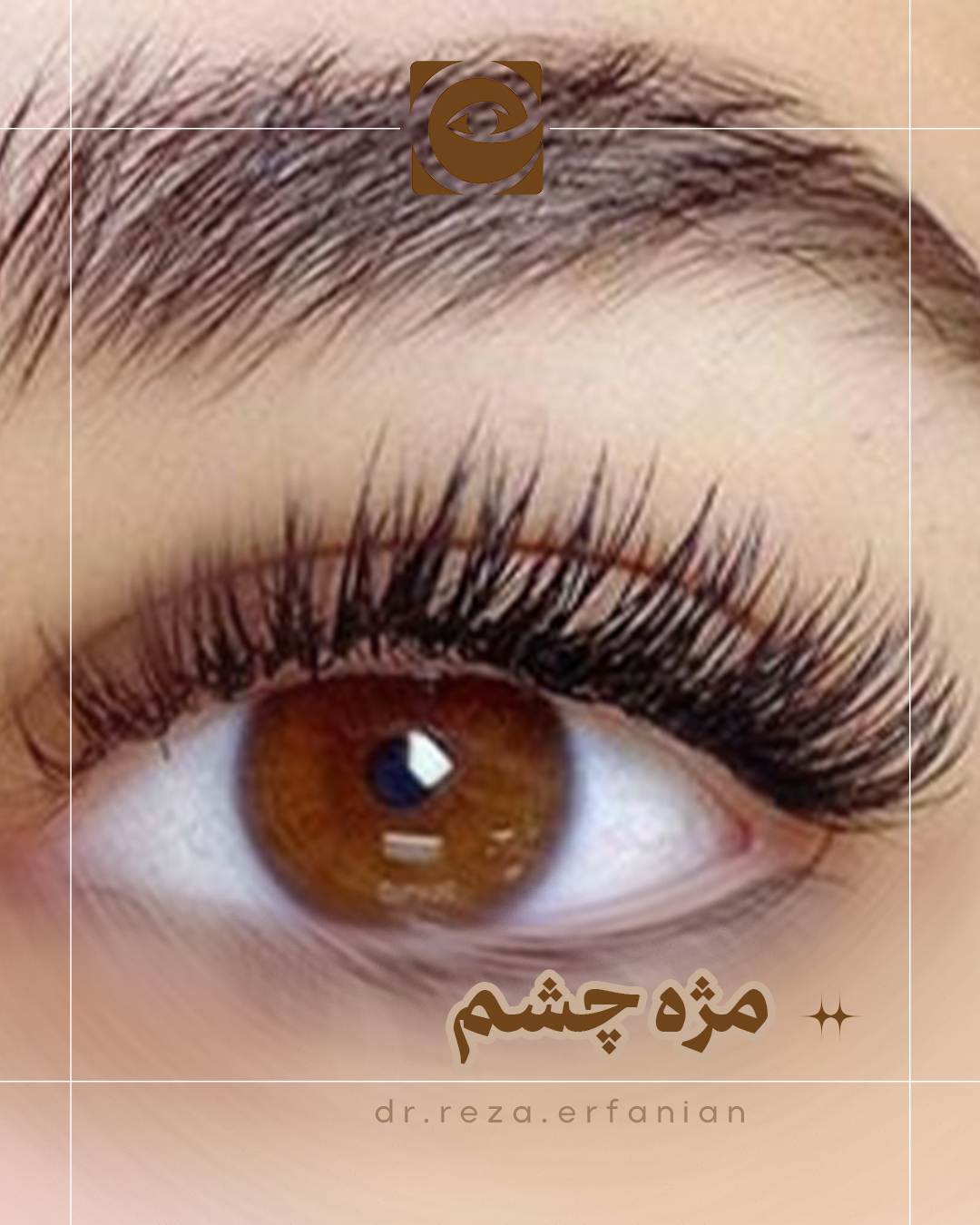 مژه ها - حقایق شگفت انگیز در مورد مژه ها! - دکتر رضا عرفانیان سلیم