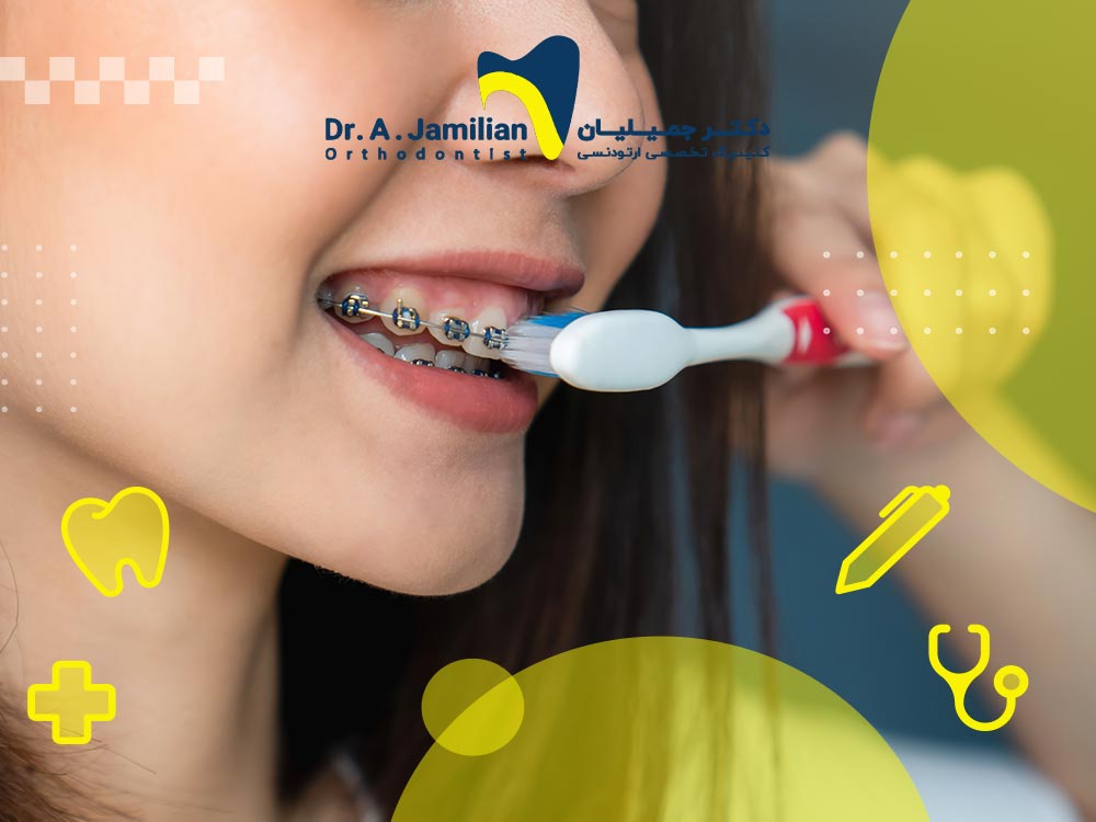 چرا مسواک معمولی برای ارتودنسی ثابت مناسب نیست؟ - دکتر جمیلیان