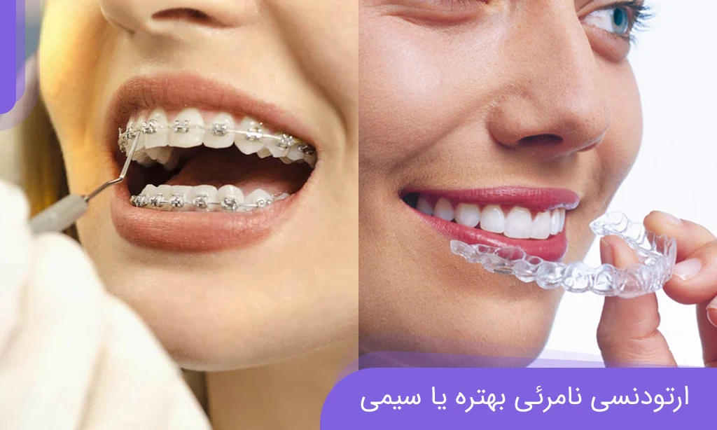 ارتودنسی نامرئی یا سیمی؟ (مقایسه واقعی از دیدگاه یک متخصص) دکتر خدوی