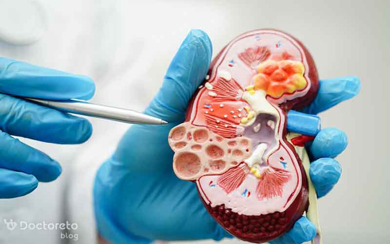 What is the relationship between diabetes and kidney disease?