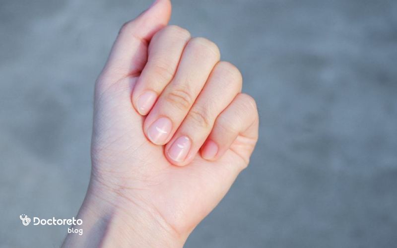 بررسی علل ایجاد لک روی ناخن و راه های درمان آن