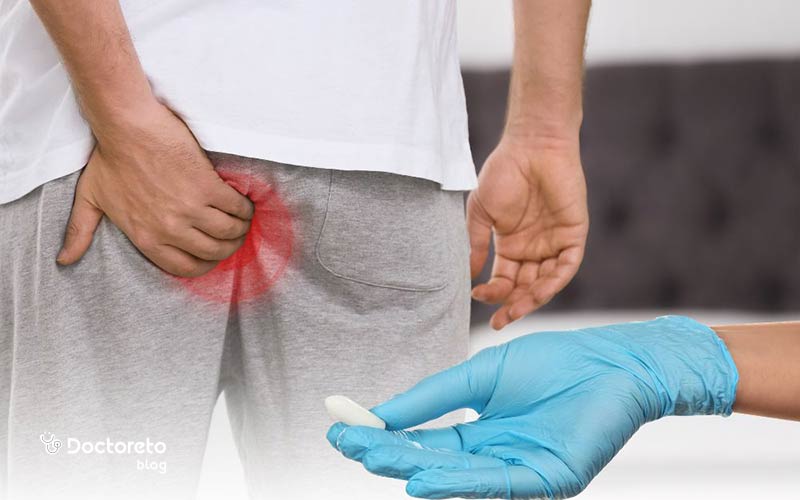 آشنایی با نحوه انتخاب بهترین قرص برای درمان هموروئید