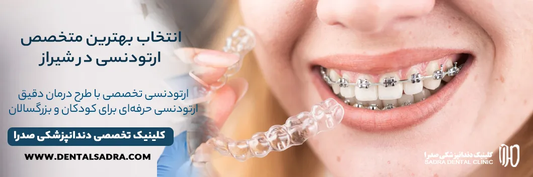 بهترین متخصص ارتودنسی در شیراز راهنمای انتخاب + معرفی کلینیک صدرا