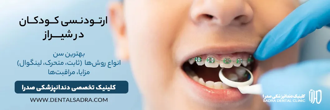 ارتودنسی کودکان در شیراز راهنمای علمی، سن درمان، روش و انتخاب بهترین متخصص