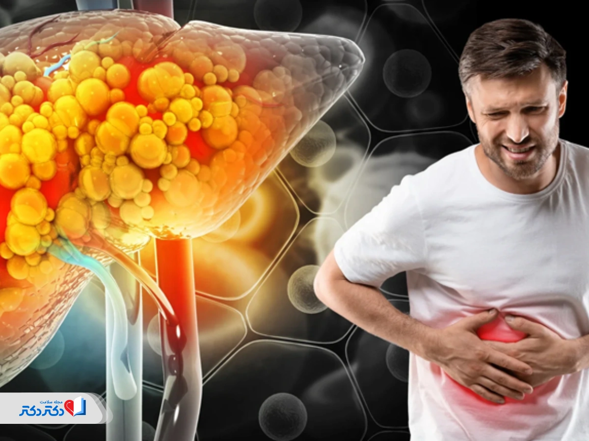Grade 2 fatty liver From warning signs to definitive treatment and complications