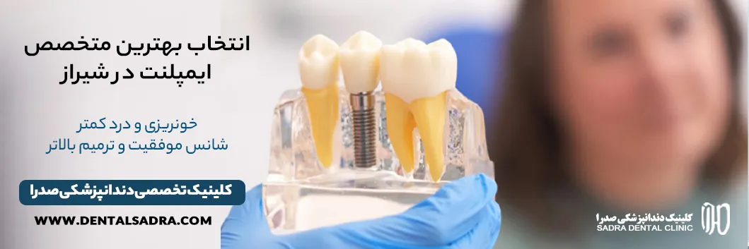 بهترین متخصص ایمپلنت در شیراز راهنمای جامع انتخاب آگاهانه + معرفی کلینیک صدرا