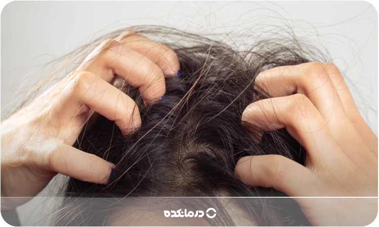 itchy scalp; 18 causes [medical treatment + 11 home remedies]
