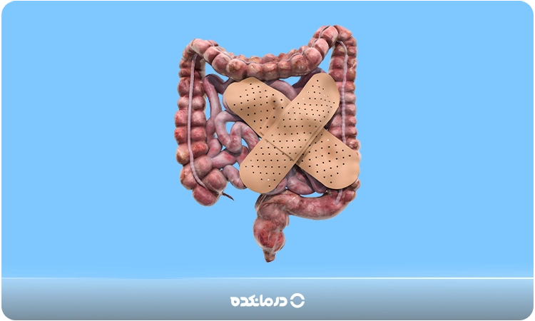 What is intestinal colitis and what are its symptoms? [3 causes + definitive treatment]