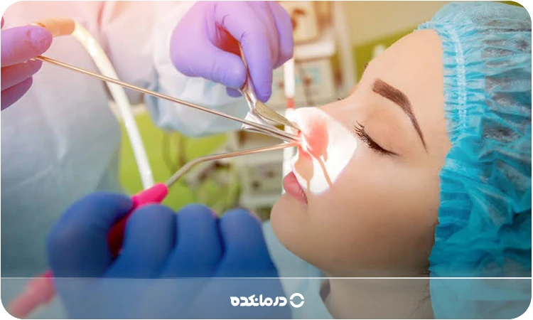 ما هي جراحة البوليبات الأنفية؟ ما هي الطريقة الأفضل؟